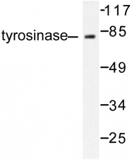 AP06471PU-N - Tyrosinase (TYR)