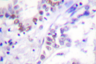 AP06472PU-N - SAE2 / UBA2