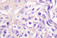 AP06473PU-N - UBA7 / UBE1L