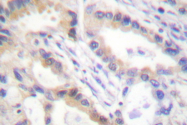 AP06475PU-N - Urocortin / UCN