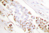 AP06480PU-N - XRCC1