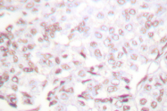 AP06481PU-N - XRCC2