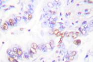 AP06482PU-N - XRCC3
