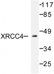 AP06483PU-N - XRCC4