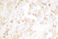 AP06485PU-N - XRCC6 / Ku70