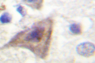 AP06491PU-N - AKT1S1 / PRAS40