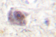 AP06494PU-N - APC / DP2.5