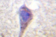AP06499PU-N - BCR