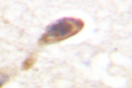 AP06503PU-N - CAMK4