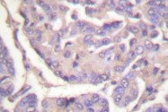 AP06505PU-N - CBL / RNF55