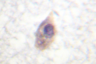 AP06509PU-N - CDC25B