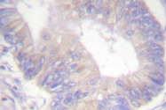AP06511PU-N - ABCC7 / CFTR