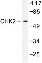 AP06512PU-N - CHK2
