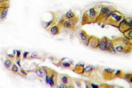 AP06519PU-N - EGFR / ERBB1