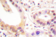 AP06524PU-N - ETS1