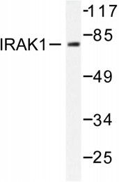 AP06527PU-N - IRAK1