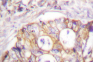 AP06531PU-N - Cytokeratin 8