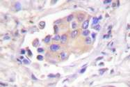 AP06535PU-N - MAP2K1