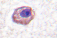 AP06538PU-N - MYL12B