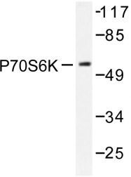 AP06552PU-N - RPS6KB1 / STK14A