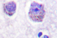 AP06552PU-N - RPS6KB1 / STK14A