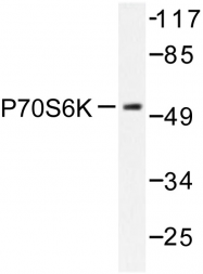 AP06554PU-N - RPS6KB1 / STK14A