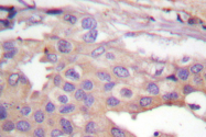 AP06554PU-N - RPS6KB1 / STK14A