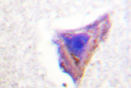 AP06556PU-N - PAK1/PAK2/PAK3