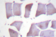 AP06559PU-N - PEA15