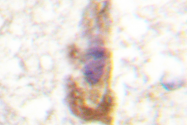 AP06565PU-N - PRKCZ