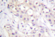 AP06566PU-N - PKC