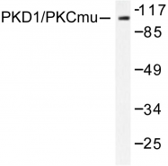 AP06568PU-N - PRKD1