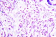 AP06573PU-N - PPAR-gamma