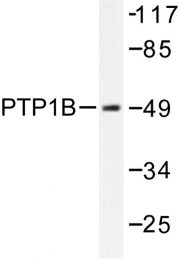 AP06575PU-N - PTPN1