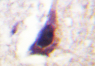 AP06575PU-N - PTPN1