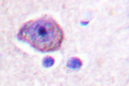 AP06577PU-N - Rhodopsin