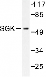 AP06580PU-N - SGK1 / SGK