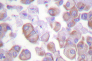 AP06582PU-N - Alpha-Synuclein / SNCA