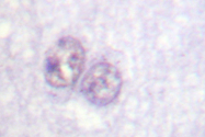 AP06584PU-N - SP1 / TSFP1