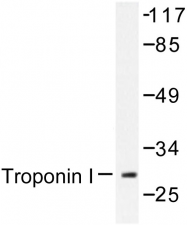 AP06588PU-N - Cardiac Troponin I