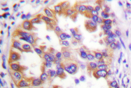 AP06590PU-N - Tuberin / TSC2