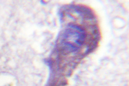 AP06591PU-N - Tuberin / TSC2