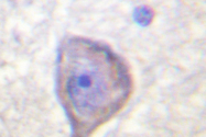 AP06592PU-N - VEGFR-1 / Flt-1