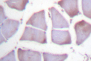 AP06595PU-N - IAP3 / BIRC4