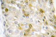 AP06611PU-N - Catenin beta-1