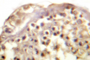 AP06612PU-N - AP-1 / c-Jun