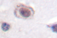 AP06613PU-N - Cyclin D1