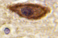 AP06615PU-N - IFNAR1