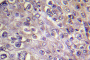 AP06618PU-N - RhoA