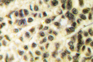 AP06619PU-N - MAPKAP Kinase-2